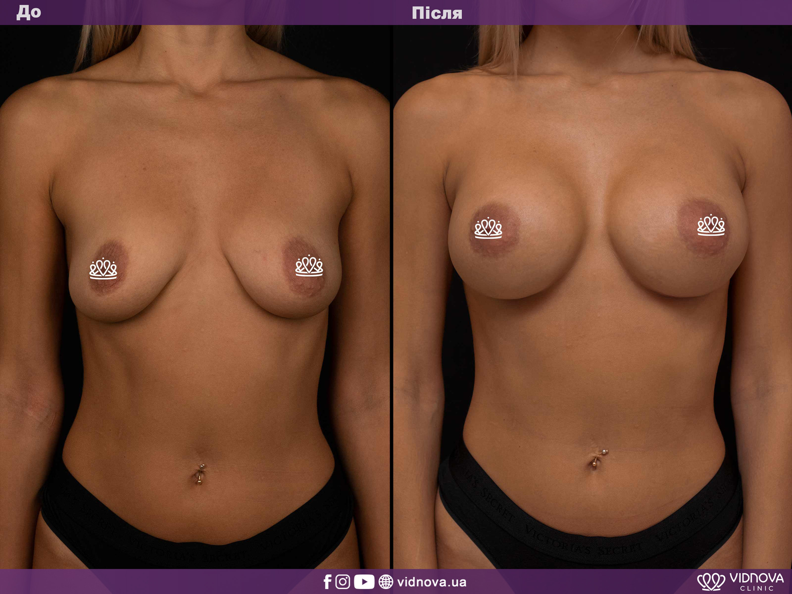 Медичний туризм з Vidnova Clinic