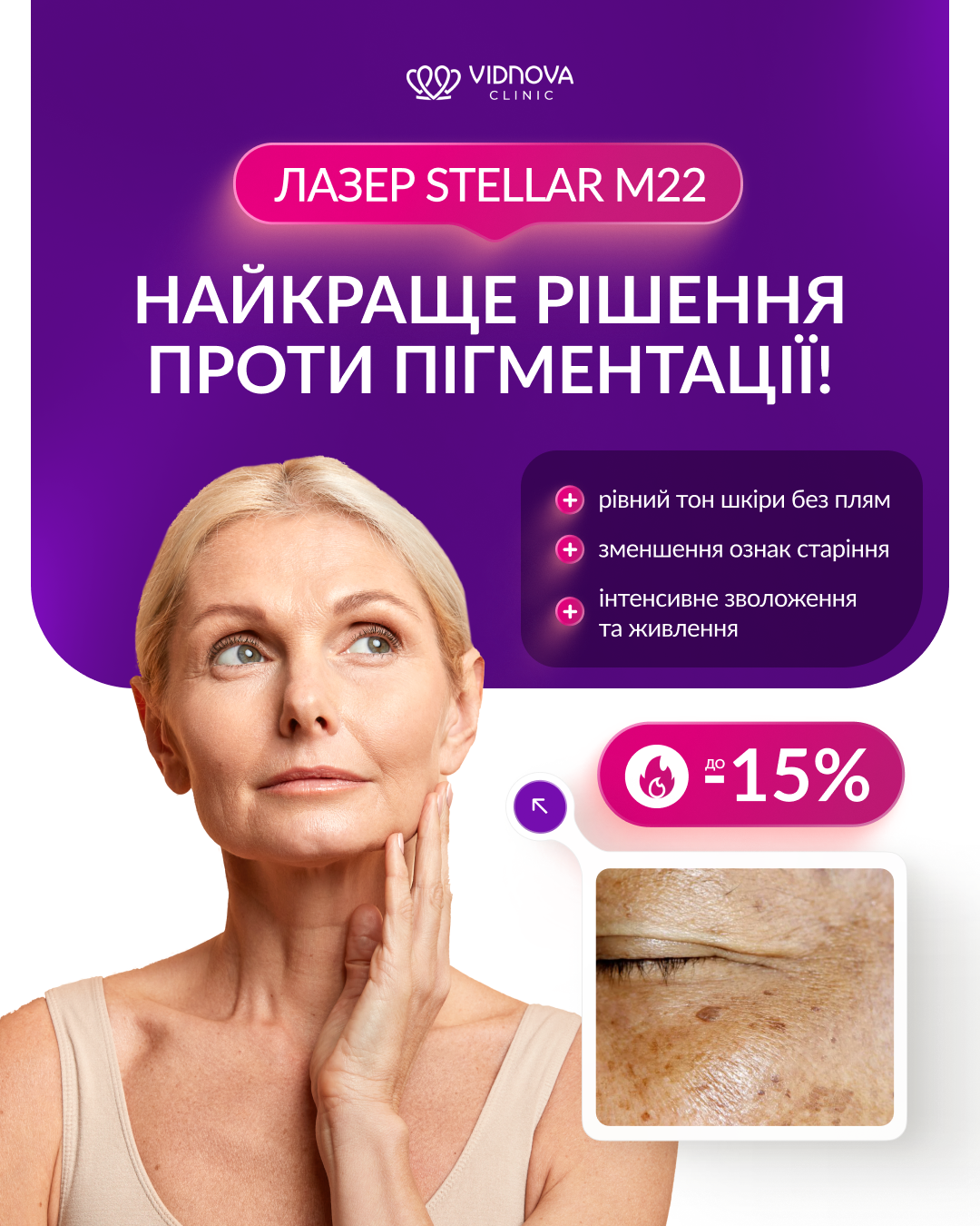 -15% на фотоомолодження Stellar М22