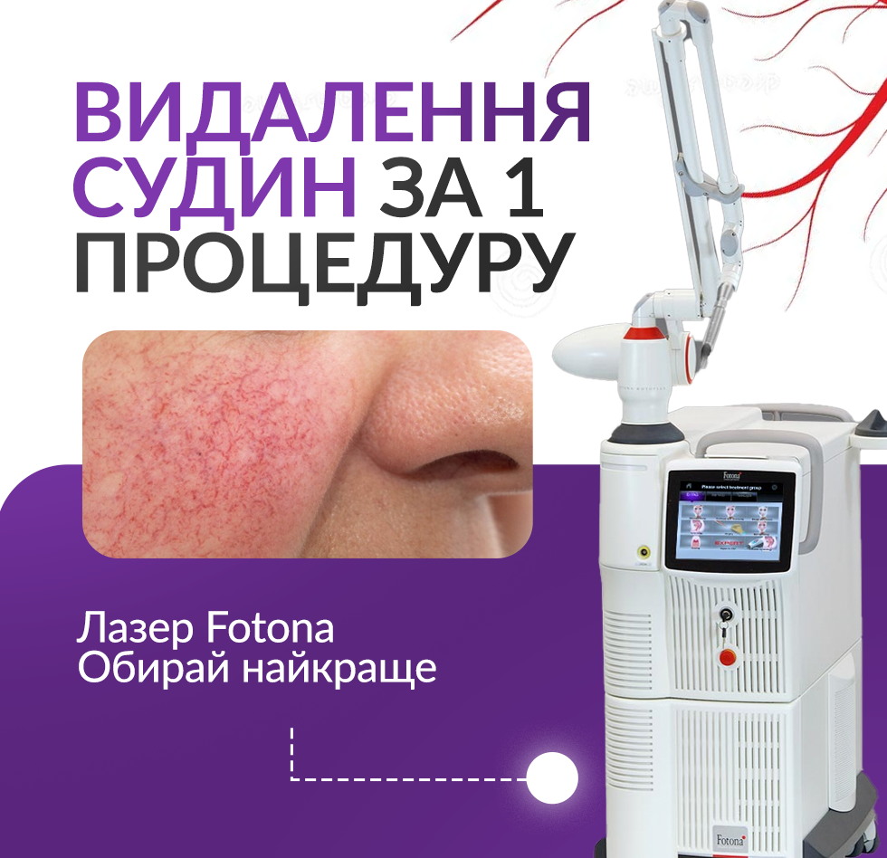 Видалення судин за одну процедуру