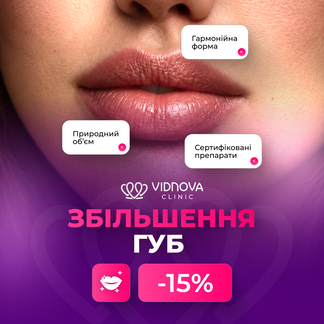 Знижка на збільшення губ -15% 👄