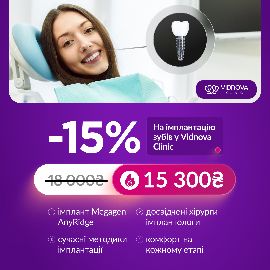 -15% на імплантацію зубів