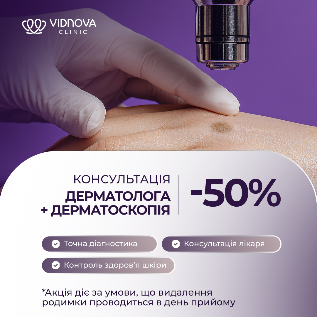 -50% на консультацію дерматолога з дерматоскопією